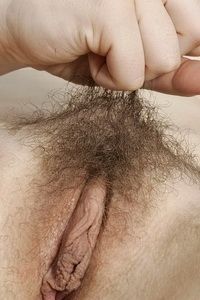 Hairy a bit